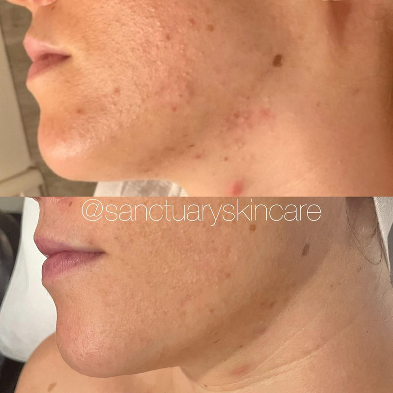 1 Month progress