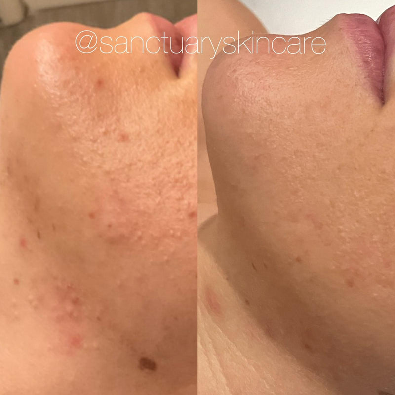 1 Month progress