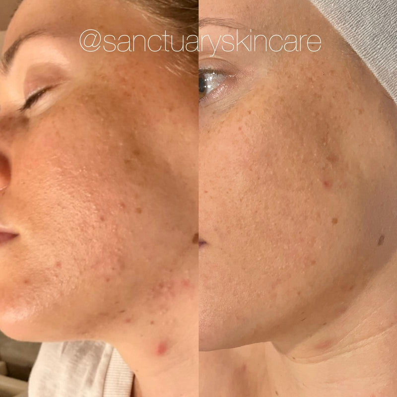 1 Month progress