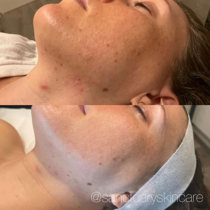 1 Month progress