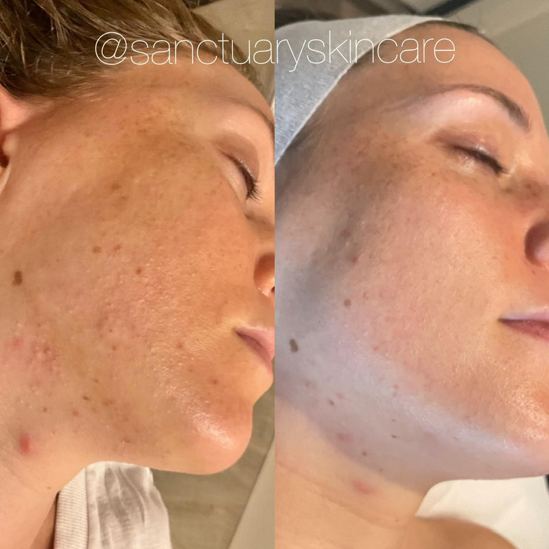 1 Month progress