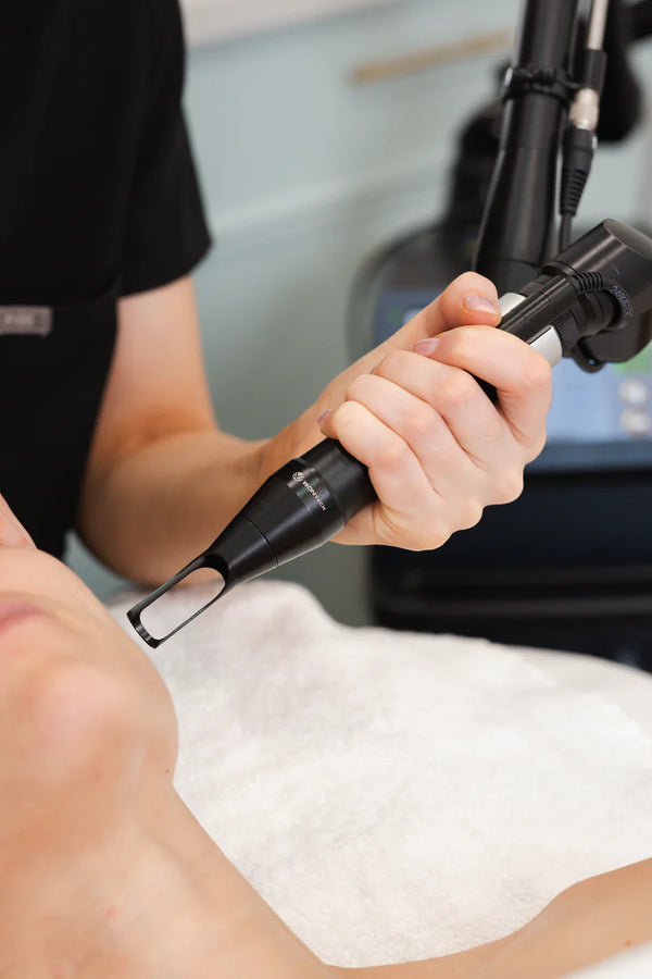 Age Spot Removal at Sanctuary Skin Care