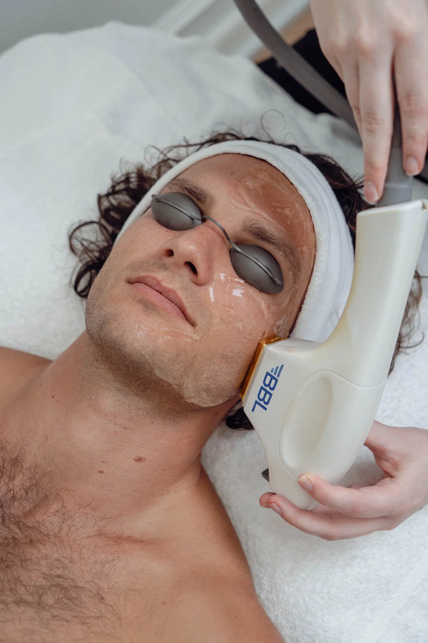 Man receiving a BBL Skintyte facial treatment on his face.