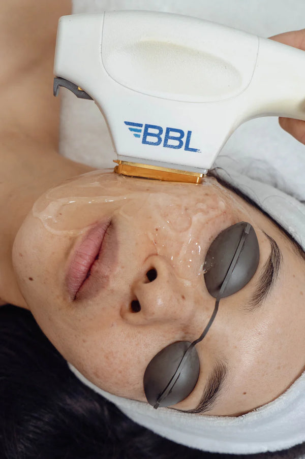 BBL Skintyte at Sanctuary Skin Care