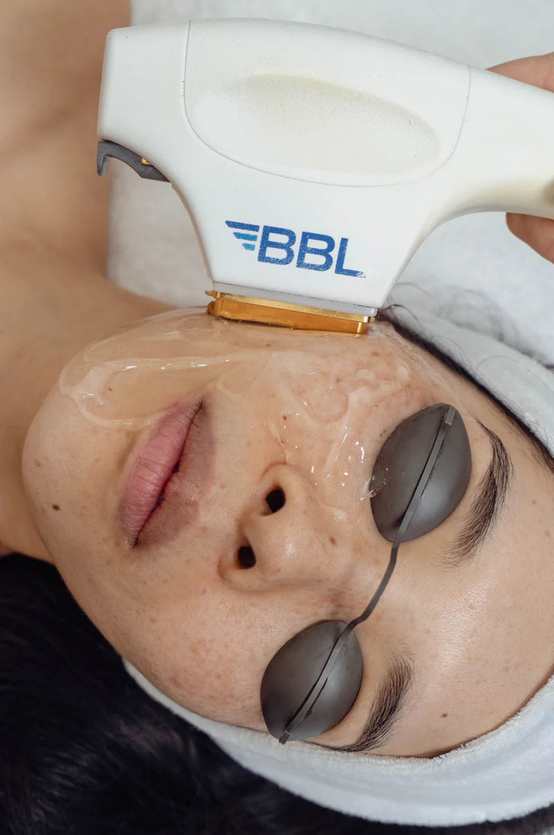 BBL Skintyte at Sanctuary Skin Care