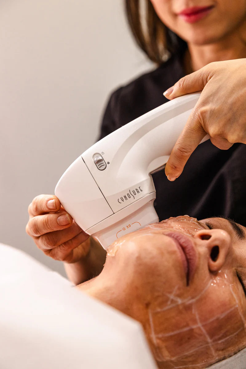 HIFU at Sanctuary Skin Care