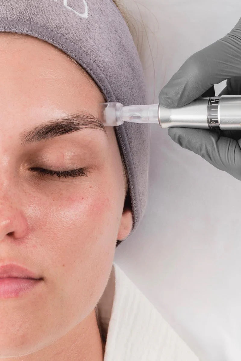 Skin Needling at Sanctuary Skin Care