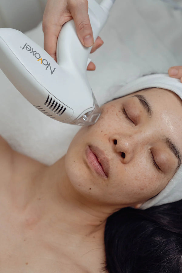 Person receiving a facial treatment with a Tixel device.