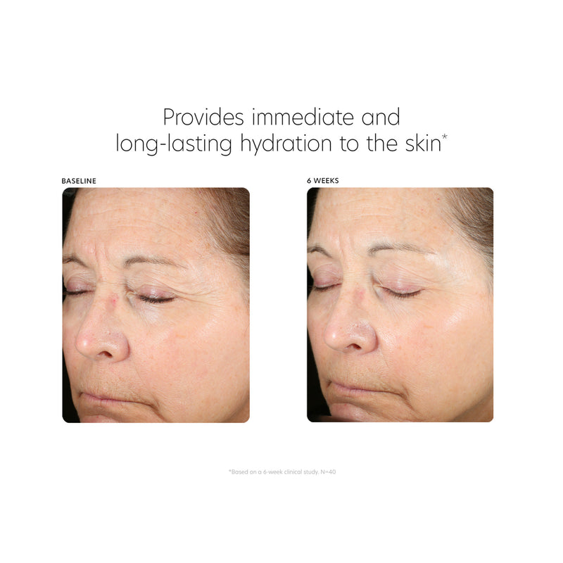 Hyaluronic Acid Boosting Serum 30ml