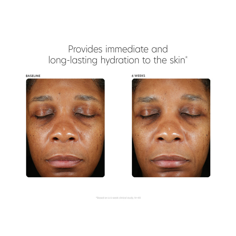Hyaluronic Acid Boosting Serum 30ml
