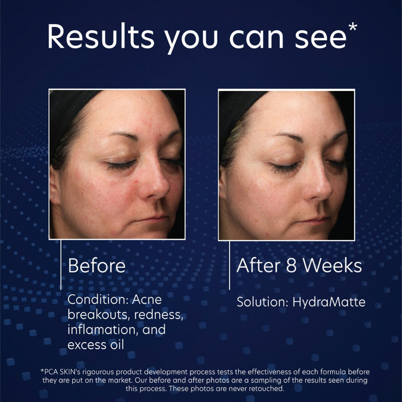 HydraMatte 51g