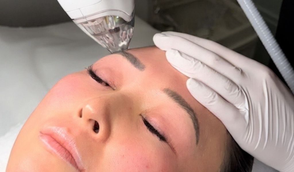Closeup of Tixel skin tightening treatment