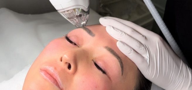 Closeup of Tixel skin tightening treatment